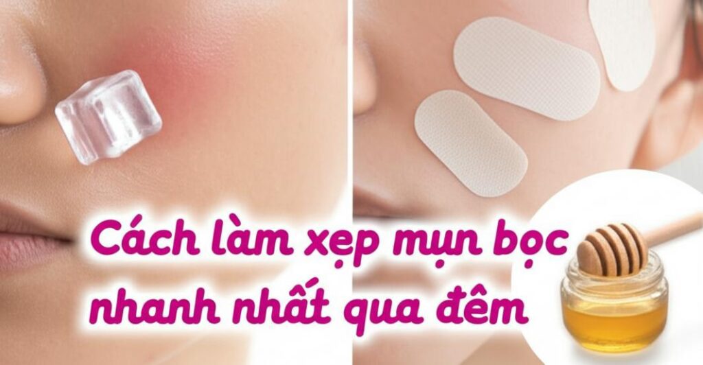 Các cách trị mụn bọc nhanh qua đêm.